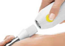Bosch Mixeur-Plongeur Blanc/Jaune-MSM66110Y