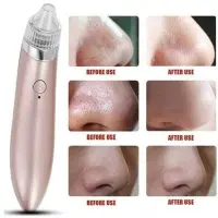 Ultrasonique XN-8030 aspirateur nettoyant points noirs